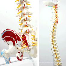 SPINE05-1 (12378) Medizinische Anatomie Human Flexible Wirbelsäule mit Femurköpfen und bemalten Muskeln, lebensgroße Wirbelsäulenmodelle